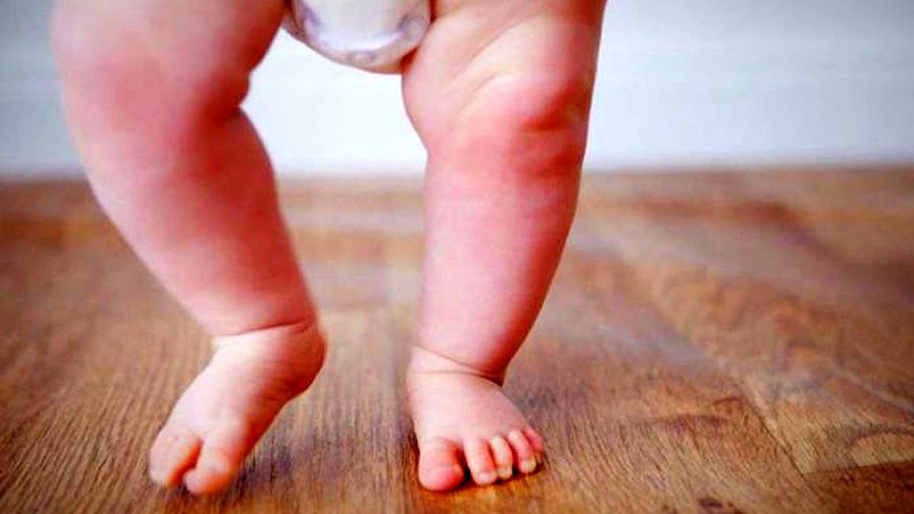 چرا کودکان دچار پای پرانتزی می شوند