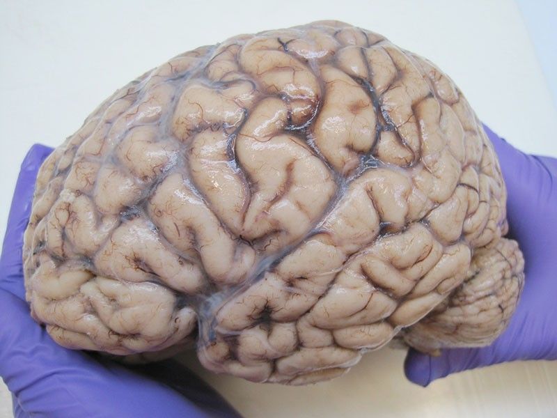 چگونه یک کِرم به کشف اسرار مغز کمک کرد؟

