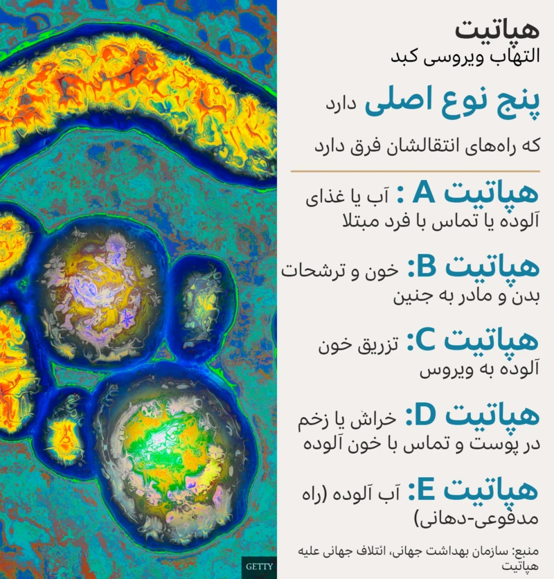 انواع هپاتیت